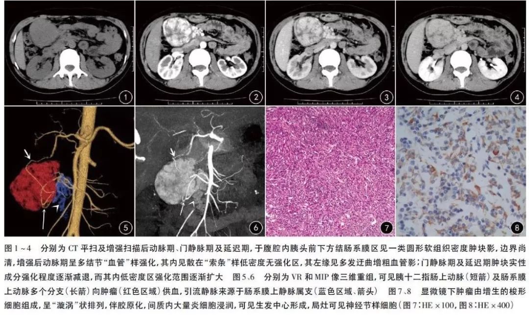 看今晚的四不像圖+正版什么,全局解答解釋落實(shí)_CT43.708